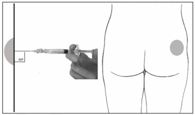 Figure 7 (Leuprolide Acetate Injection 10)